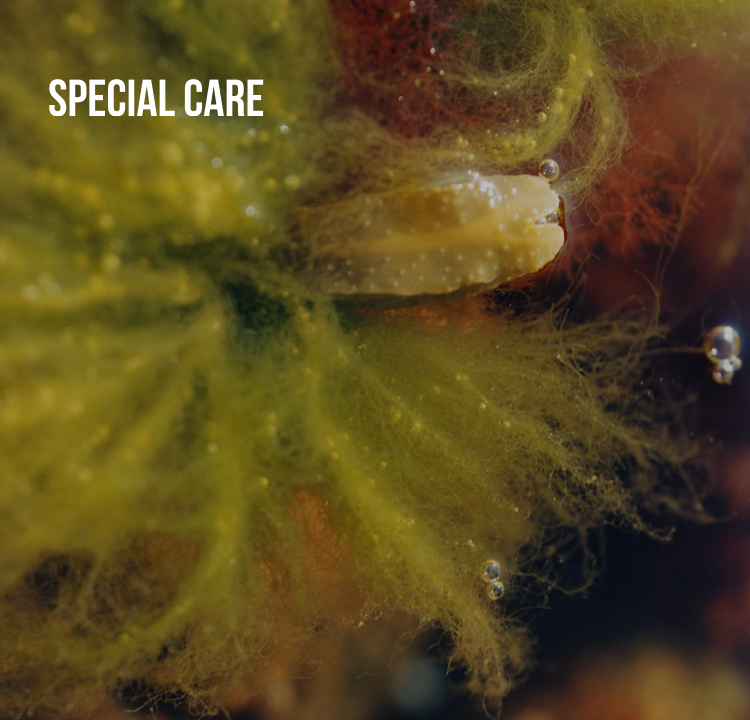SPECIAL CARE